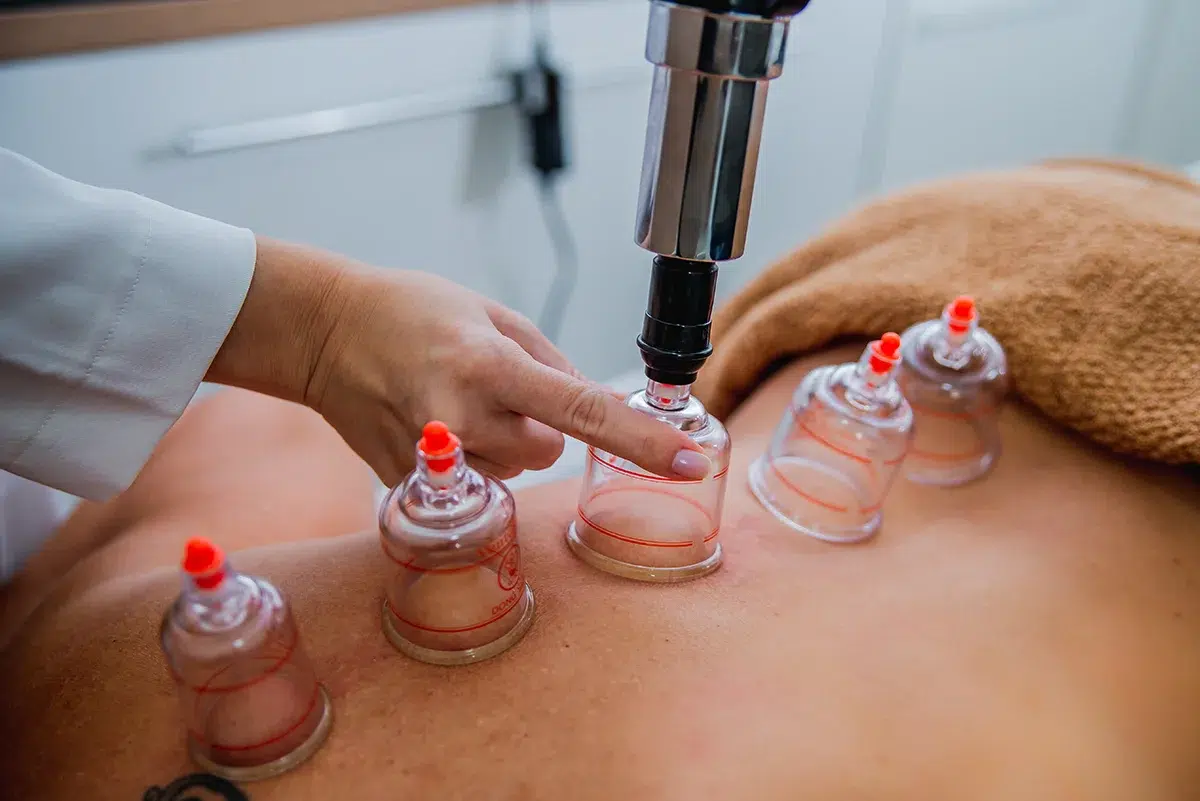 Massagem-Relaxante-com-Ventosaterapia